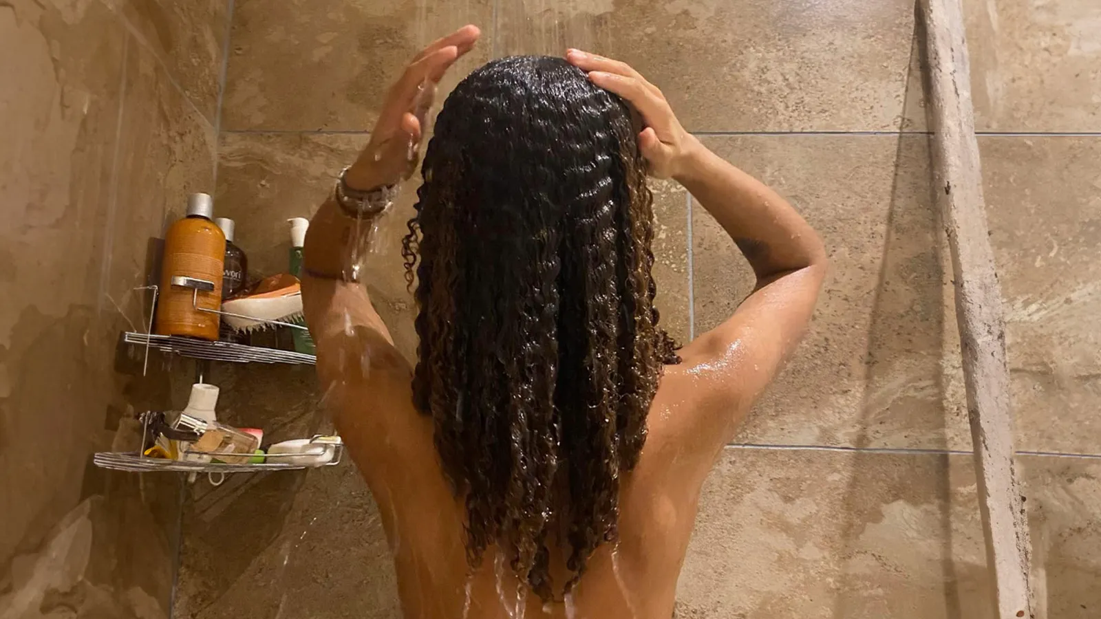 Baby Hairs or Breakage? How to Fix a Damaged Hairline and Make Your Strands Stronger