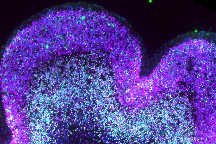 From One-Time Infusions to ‘Functional Cures’: How Single-Dose Therapies Are Reshaping Medicine