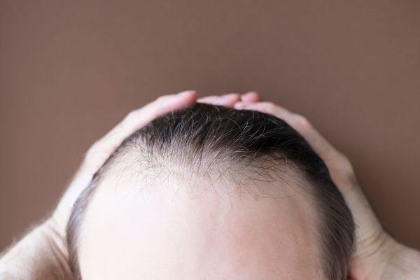 Want Fuller, Healthier Hair? The Truth About Growth Masks, Conditioners and Your Daily Habits