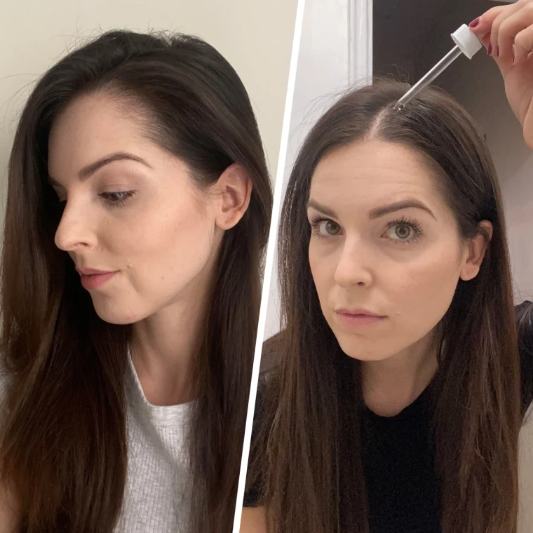 Do Hair Growth Products Actually Work? What Oils, Peptides and Treatments Can (and Can’t) Do