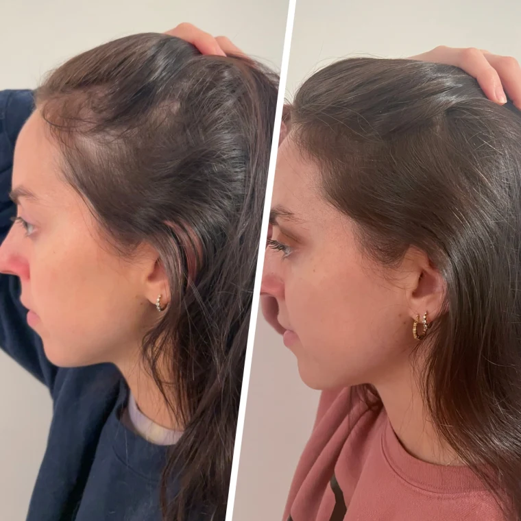 Do Hair Growth Products Actually Work? What Oils, Peptides and Treatments Can (and Can’t) Do