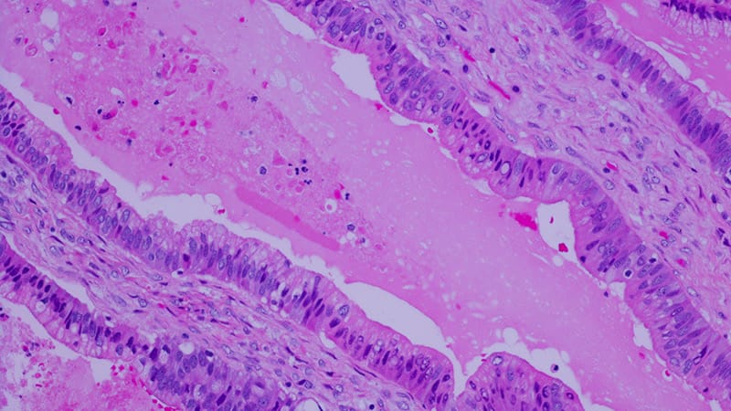 From One Shot to First-Line: How Single-Dose and Combo Therapies Are Changing Cancer Treatment