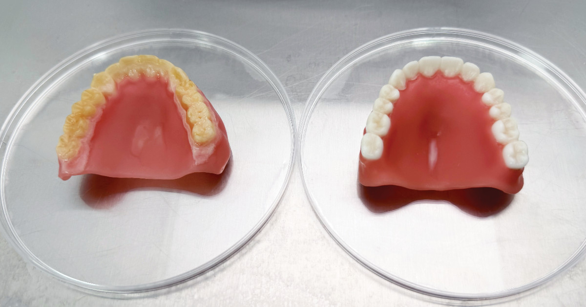 How 3D-Printed Dentures Are Fighting Bacteria and Biofilm Buildup