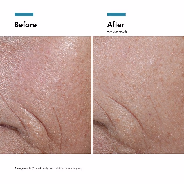 Vitamin C for Skin: What Dermatologists Actually Want You to Know