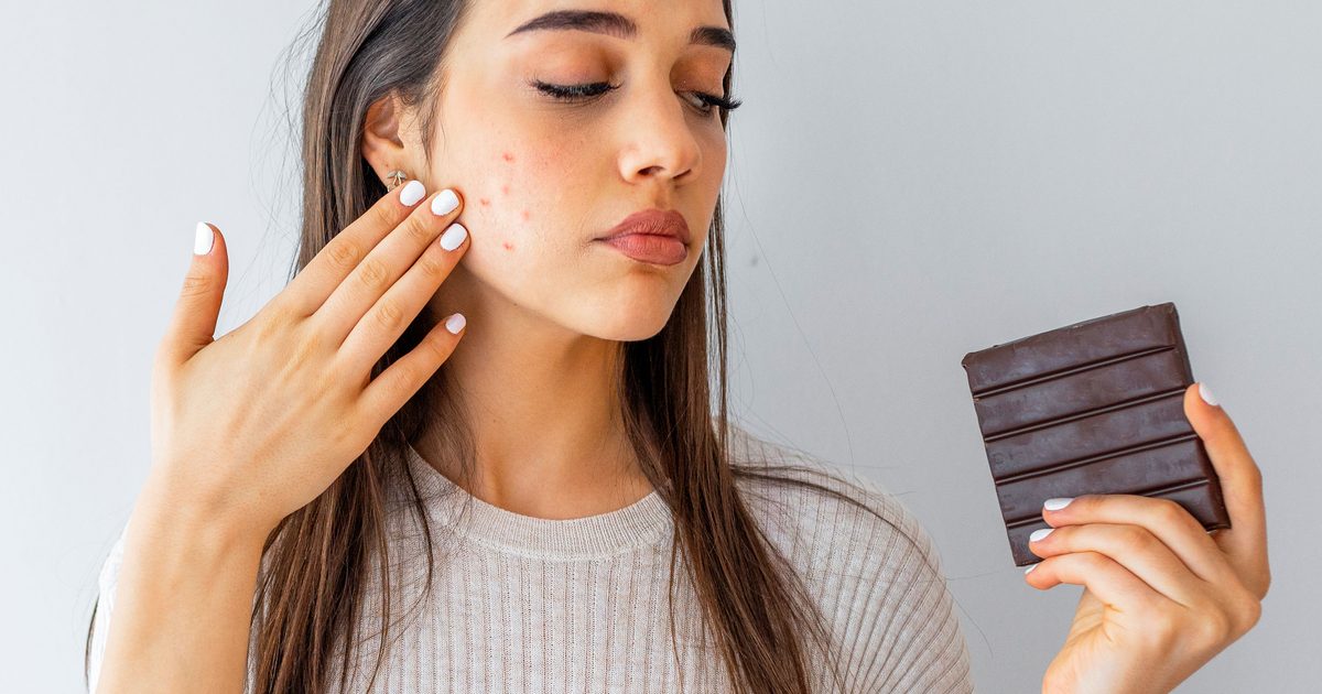 Does What You Eat Really Trigger Breakouts? What Science Says About Diet and Acne