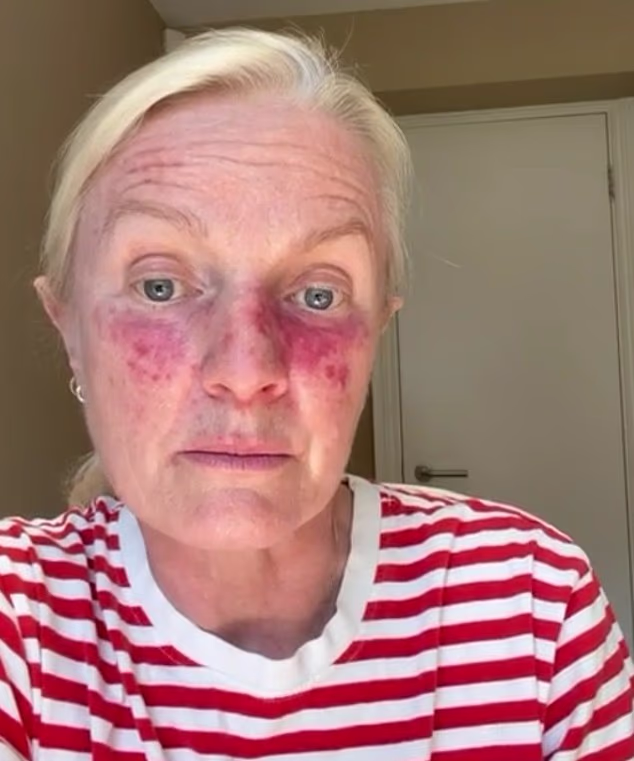 When That Rash Isn’t What You Think: How Skin Symptoms Can Hide Serious Disease