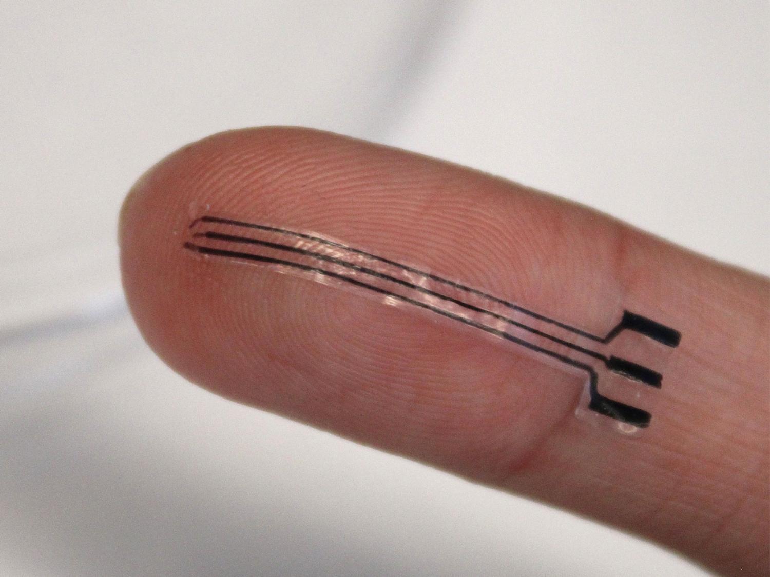 How 3D Printed Bioelectronic Implants Are Transforming High Blood Pressure Treatment