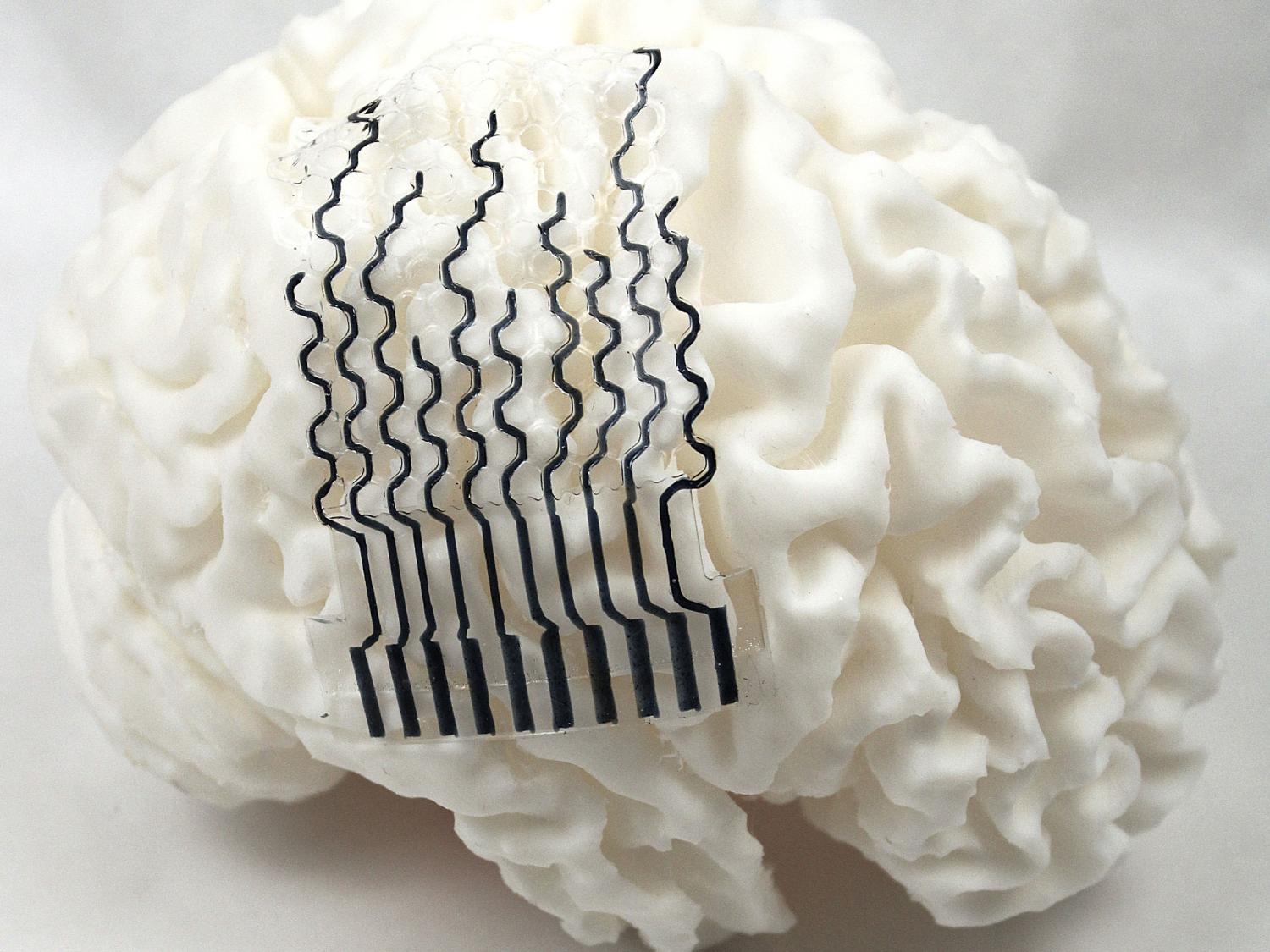 How 3D Printed Bioelectronic Implants Are Transforming High Blood Pressure Treatment