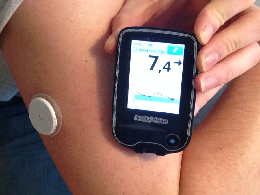 Continuous Glucose Monitors Are Becoming the New Health Data Hub—Here’s What’s Changing