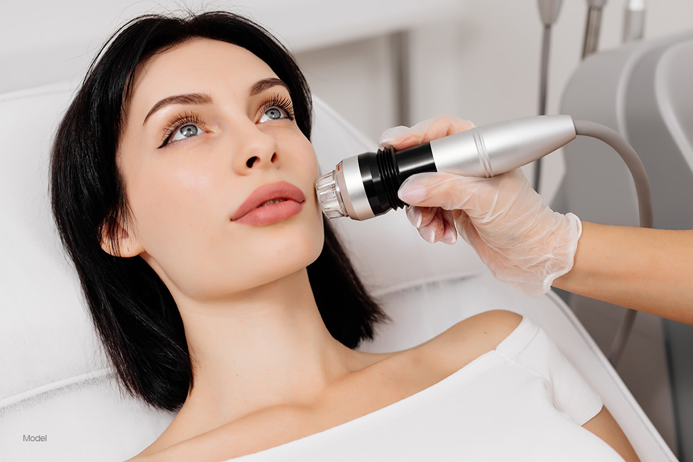 Microneedling for Scars and Fine Lines: How Collagen Remodeling Transforms Skin with Little Downtime