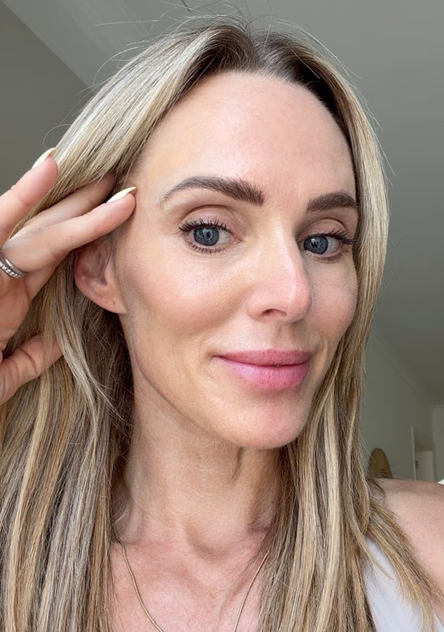 Beyond Eyeliner: Comparing the Most Effective Treatments for Hooded Eyes and Saggy Lids