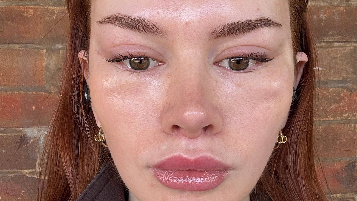The Hidden Cost of Chasing Celebrity Beauty