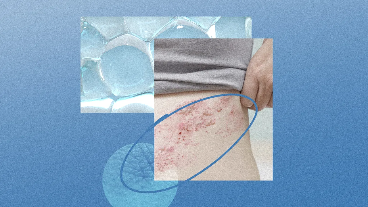 Precancerous Skin Lesions Are Rising—How to Spot and Prevent Them