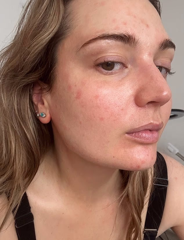 The Common Household Item Triggering Your Unexplained Facial Rash