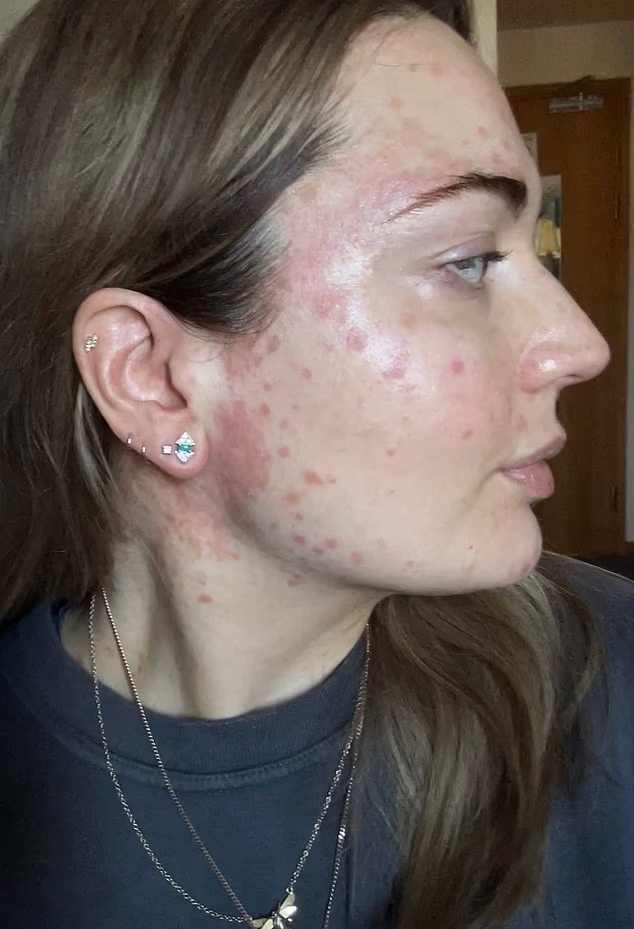 The Common Household Item Triggering Your Unexplained Facial Rash