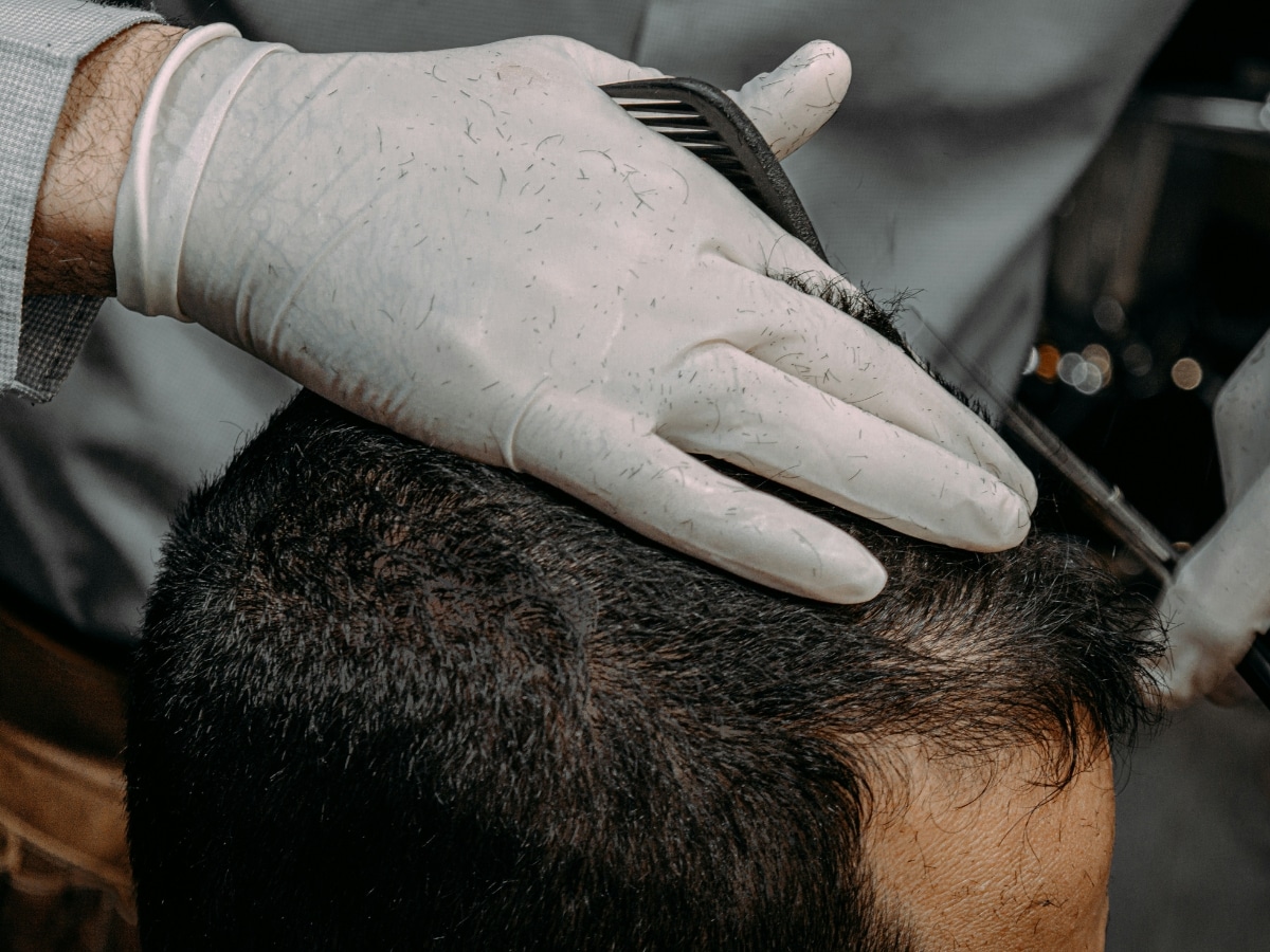 Beyond Minoxidil: A Complete Playbook for Male Hair Loss