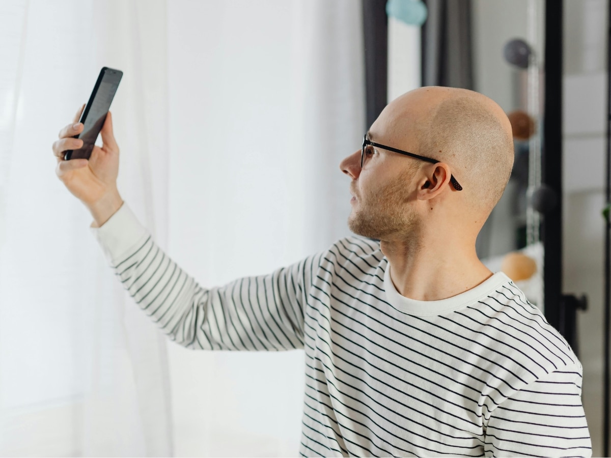 Beyond Minoxidil: A Complete Playbook for Male Hair Loss