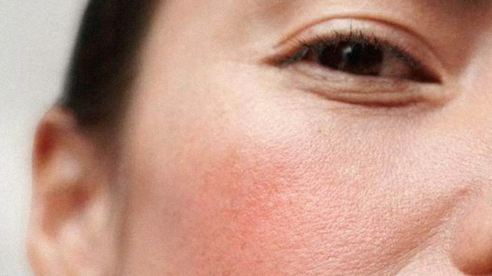 How Everyday Stress and Alcohol Quietly Sabotage Your Skin