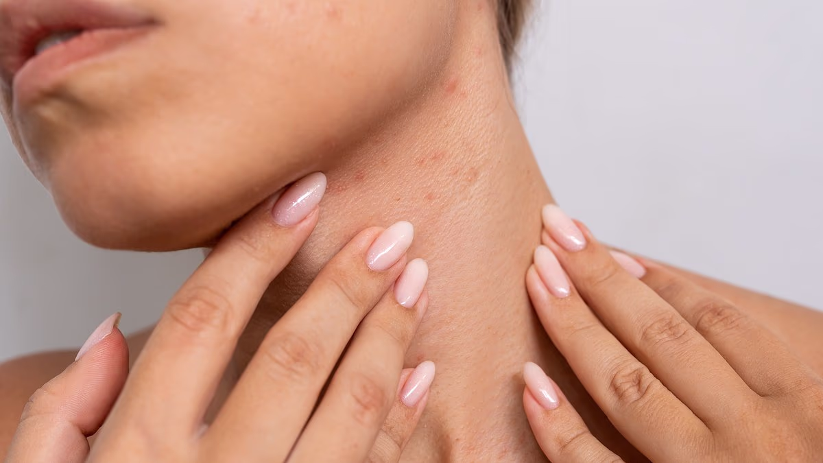 Travel Rashes and Holiday Skin Problems: How to Spot, Treat, and Prevent Them