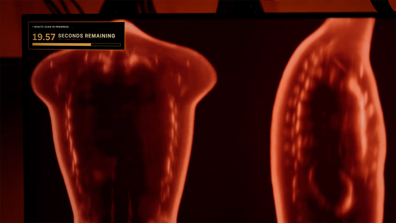 Midjourney’s Body Scanning Spa: Inside Its AI Health Imaging Bet