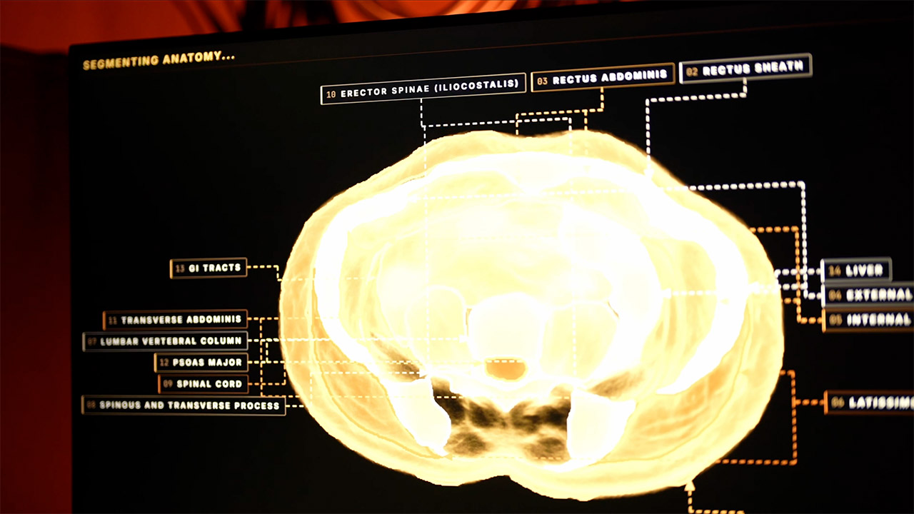 How Midjourney’s New Spa Scanner Works