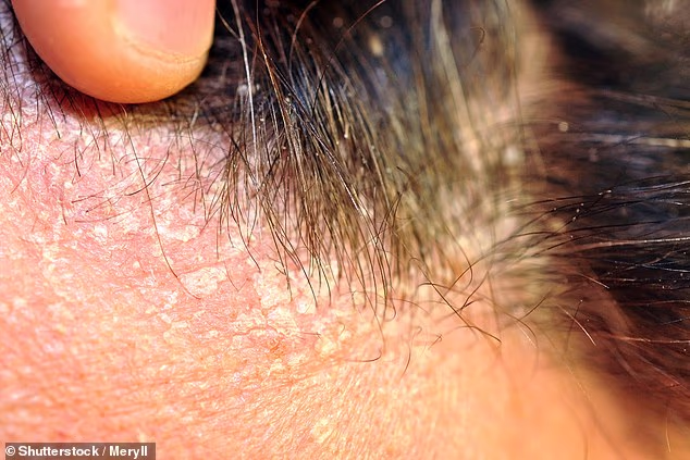 Beyond Moles: 10 Overlooked Skin Cancer Warning Signs