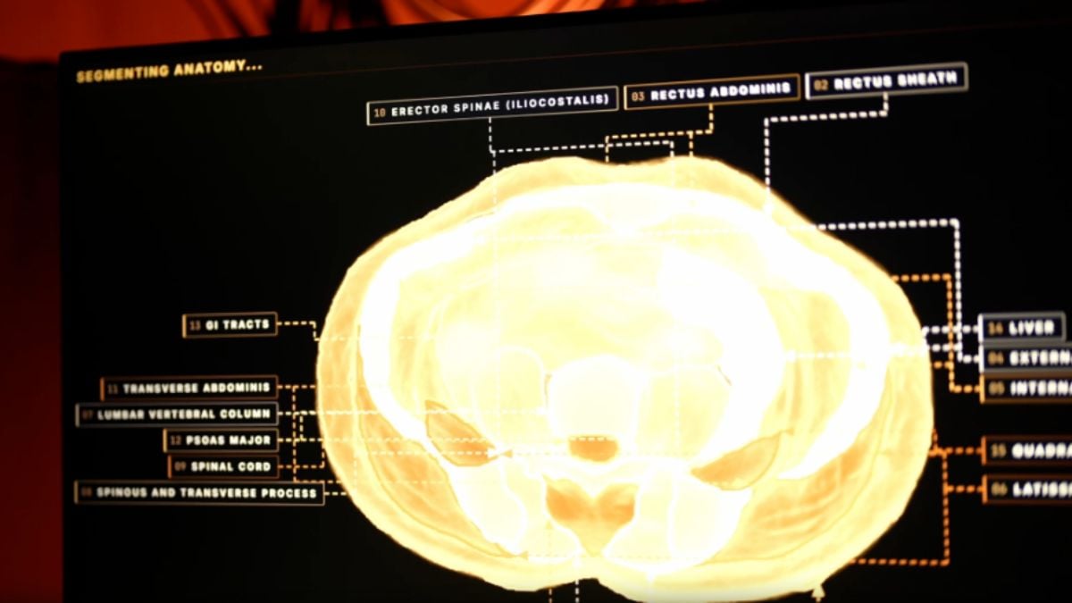 Midjourney’s 60‑Second Body Scanner: The Hidden Health Risks