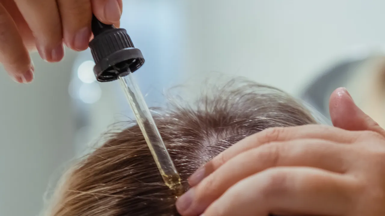 Switching to Stronger Hair Loss Treatments: Side Effects and Safety