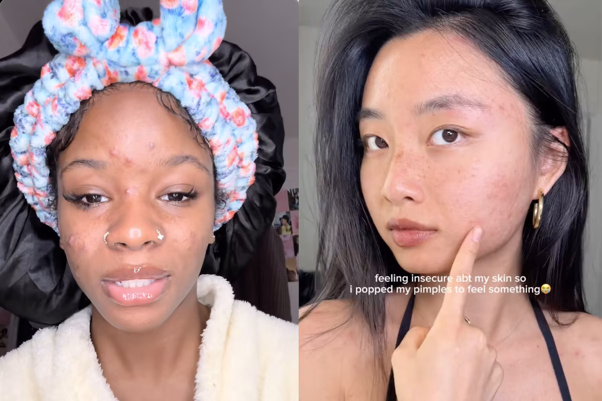 Why We Can’t Stop Watching Beauty Procedure Disasters
