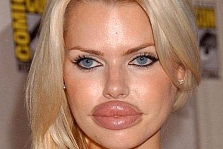 Why We Can’t Stop Watching Beauty Procedure Disasters