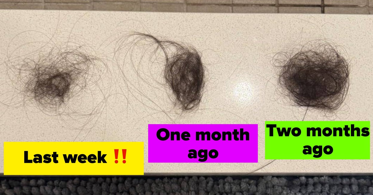 21 Scalp Care Products That Transform Hair Health