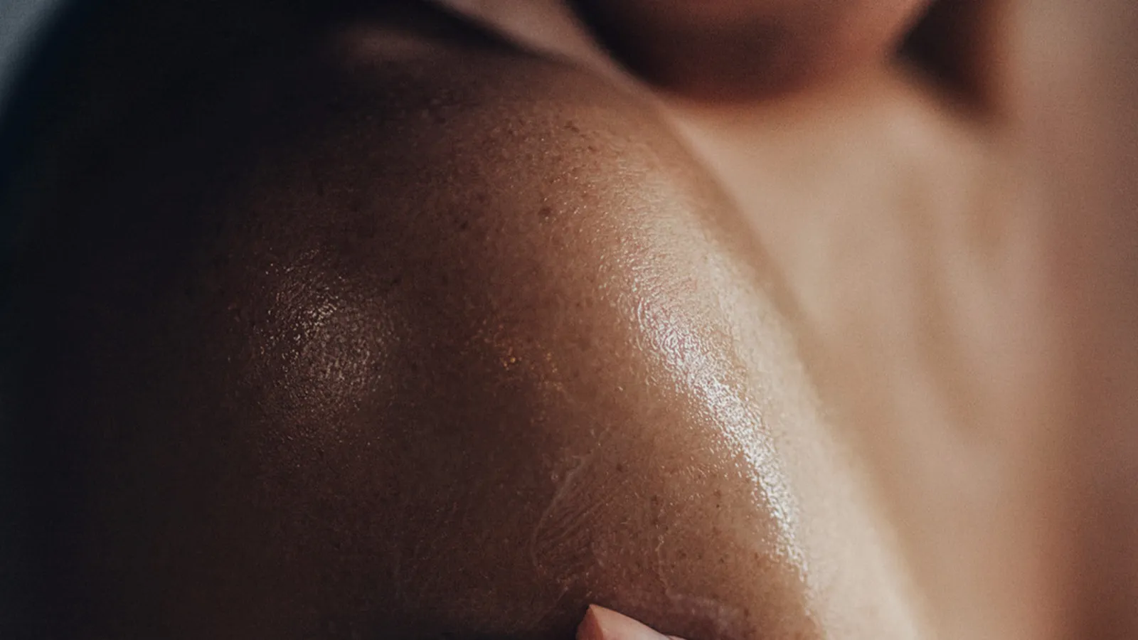 Body Acne vs. Hidden Skin Conditions: How to Tell the Difference