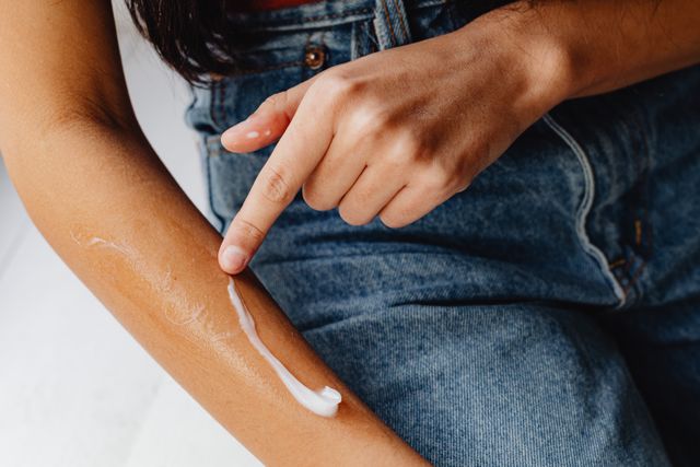 Dermatologist-Approved Natural Remedies for Eczema and Sunburn