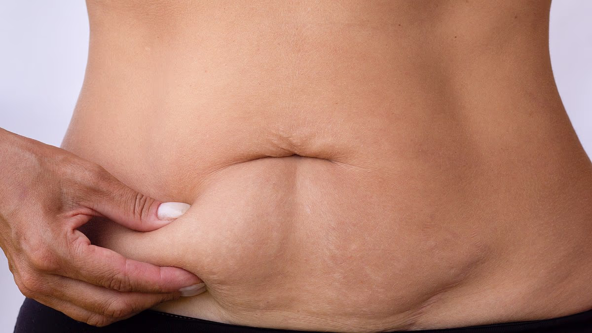 What Tightens Loose Skin Without Surgery?