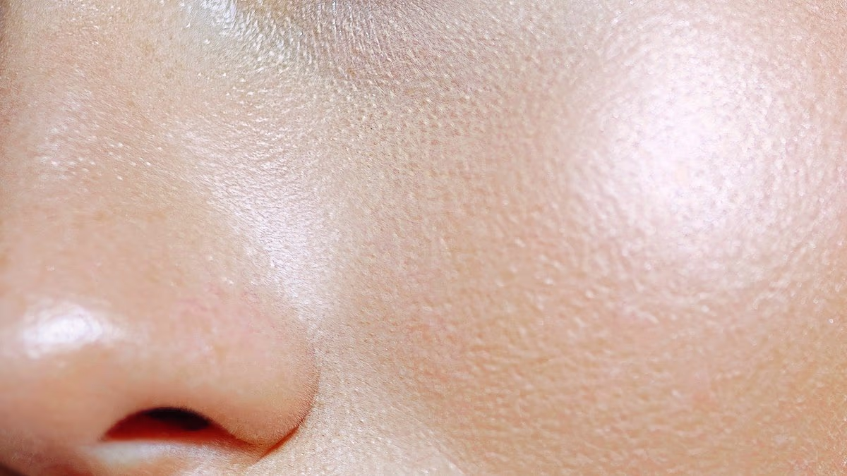 Exfoliating Acids Beyond Acne: The Best Hydroxy Acids for Fine Lines, Texture and Pores