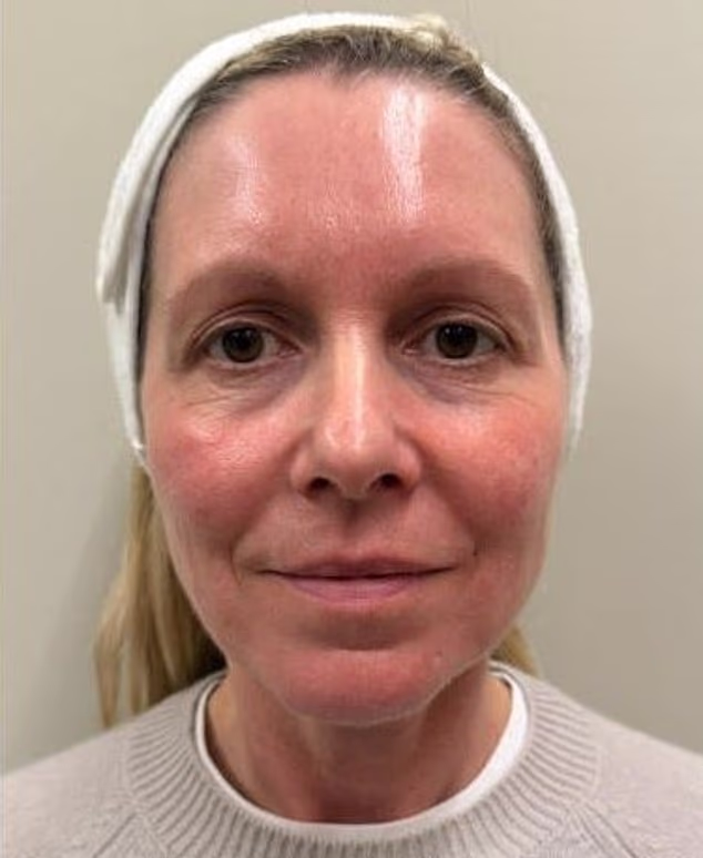 How Non-Surgical Skin Treatments Redefine the Face in Under an Hour