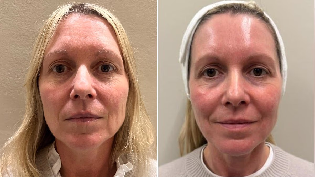 How Non-Surgical Skin Treatments Redefine the Face in Under an Hour