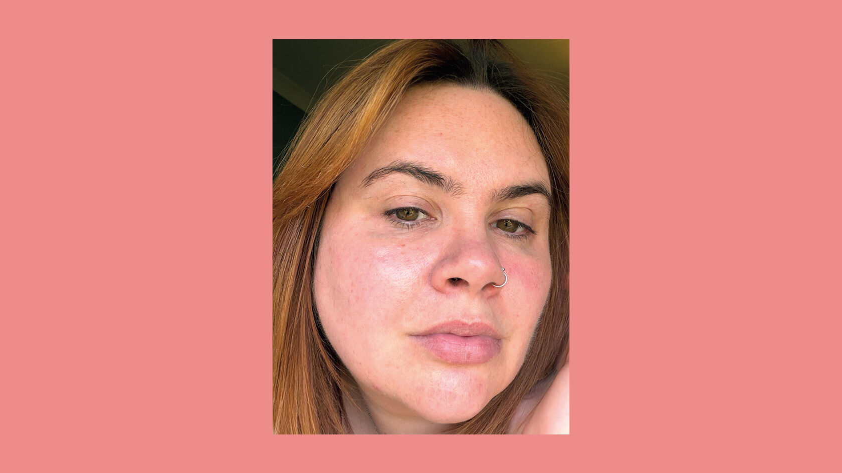 Why Your Dermatologist Should Come Before Any Skincare Haul