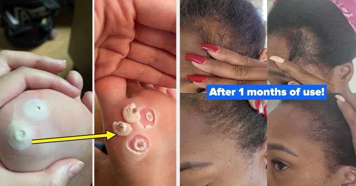 31 Affordable Skincare Products That Deliver Clinical-Level Results