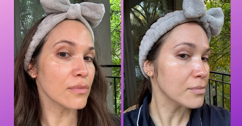 The Most Effective Dark Spot Serums Backed by Experts and Real Results