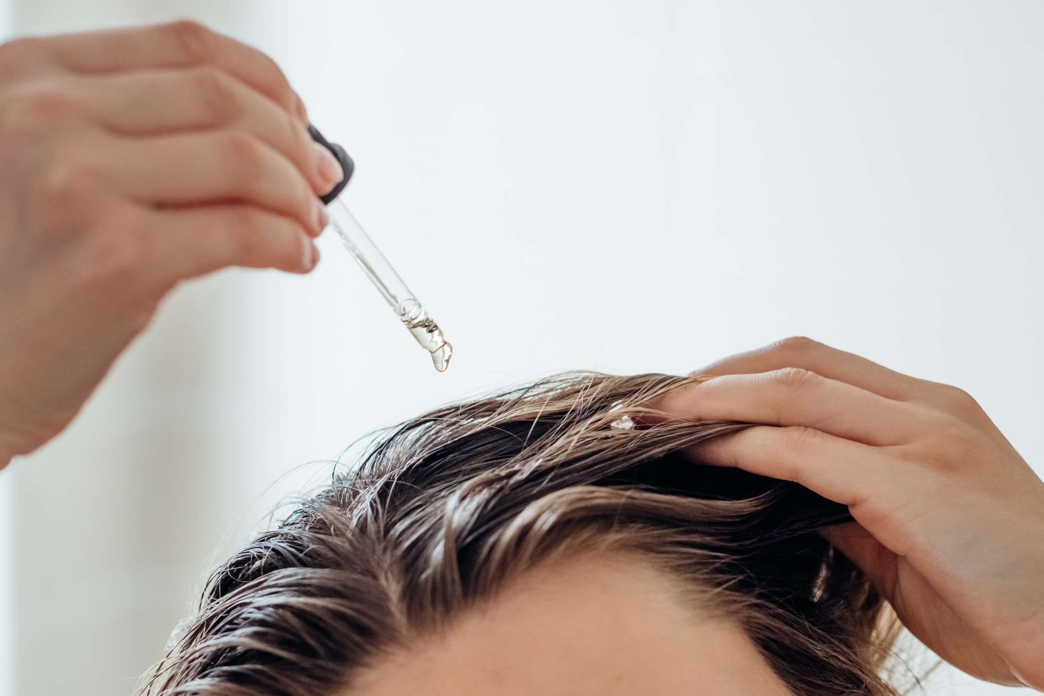Can Hair Thinning Be Reversed? Dermatologists’ Best Bets