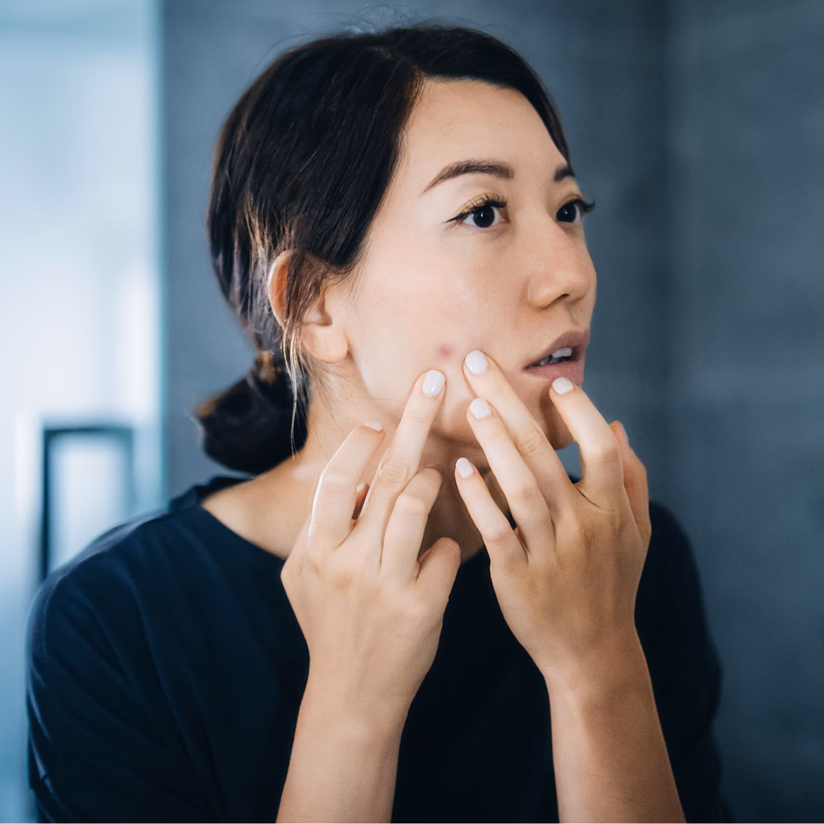 The Skincare Habits Worsening Your Summer Breakouts—and How to Fix Them