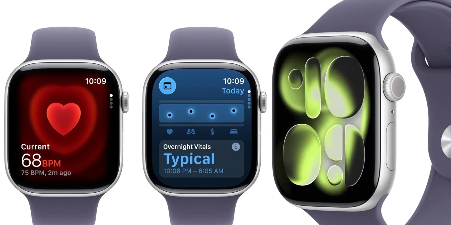 Apple Watch Series 11 Discounts Over $100 Across Sizes and Colors