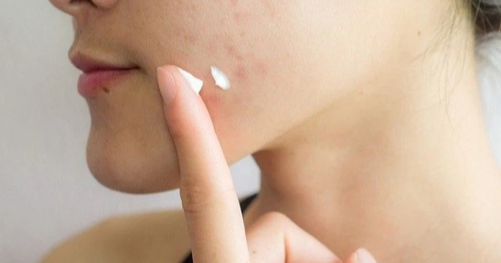 Thu hồi 5 mỹ phẩm Kencare: Lỗ hổng hồ sơ PIF và bài học cho người tiêu dùng