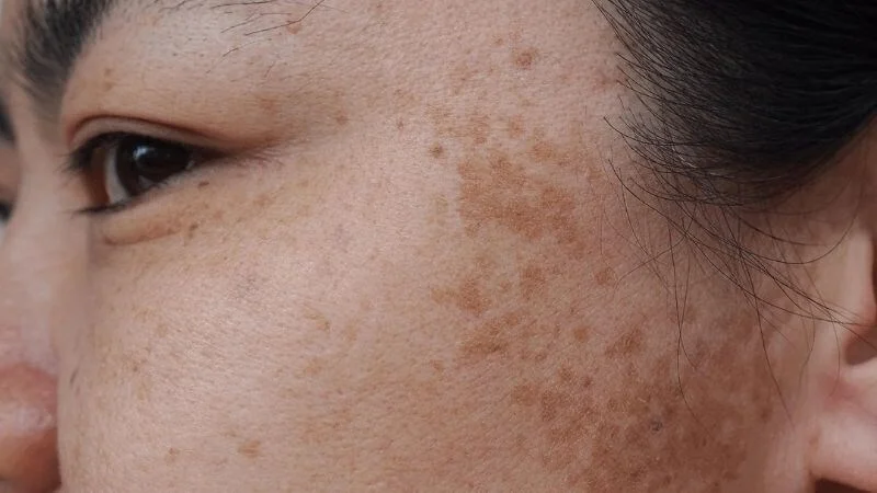 5 thói quen hằng ngày khiến skincare “mất tác dụng” và da vẫn xỉn màu