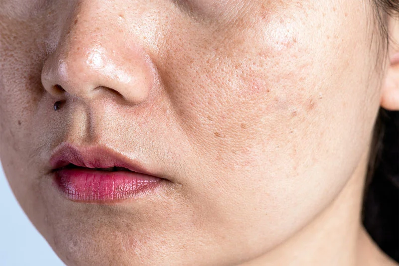 5 thói quen hằng ngày khiến skincare “mất tác dụng” và da vẫn xỉn màu