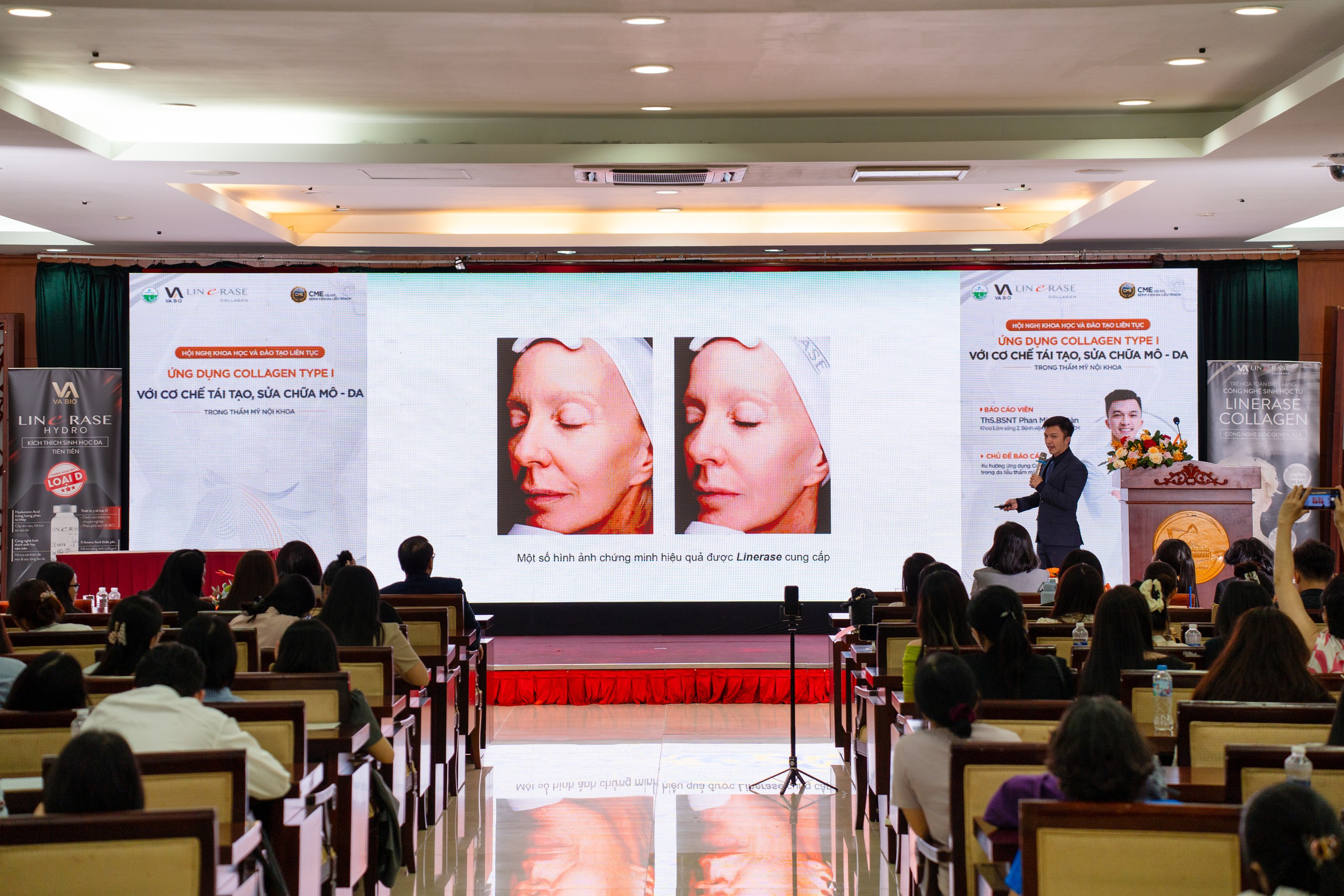 Collagen Type I trong thẩm mỹ tái tạo: Từ nghiên cứu đến thực hành