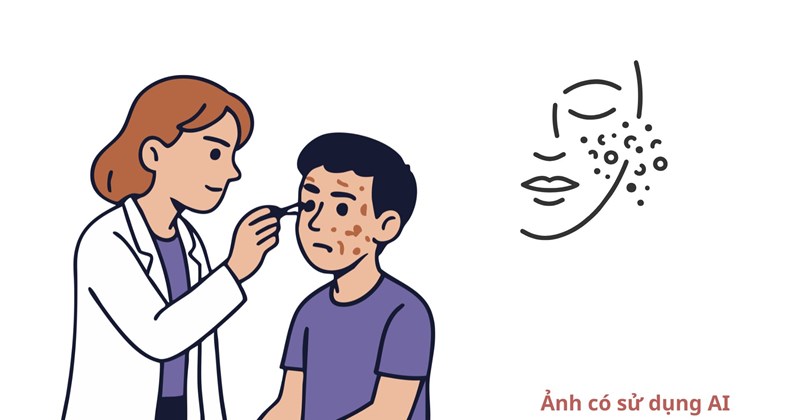 Tự dùng kem dưỡng trắng trực tuyến: Cái giá corticoid da mặt phải trả