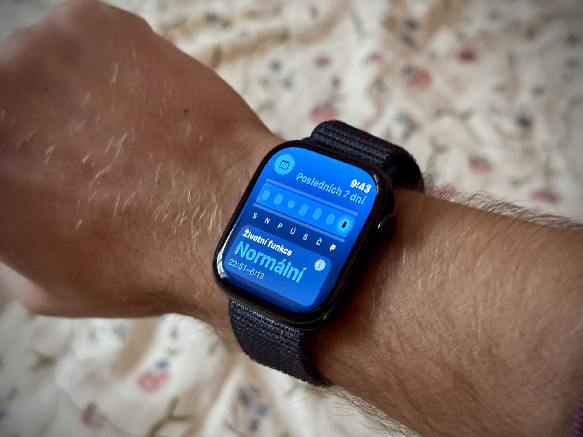 Galaxy Watch 9 hay Apple Watch Series 11: chọn chiếc đồng hồ sức khỏe nào?