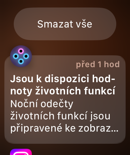 Galaxy Watch 9 hay Apple Watch Series 11: chọn chiếc đồng hồ sức khỏe nào?